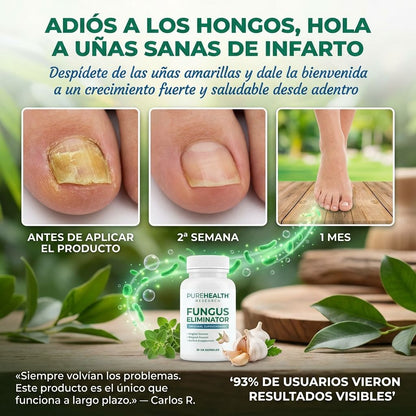Apoyo al bienestar de uñas